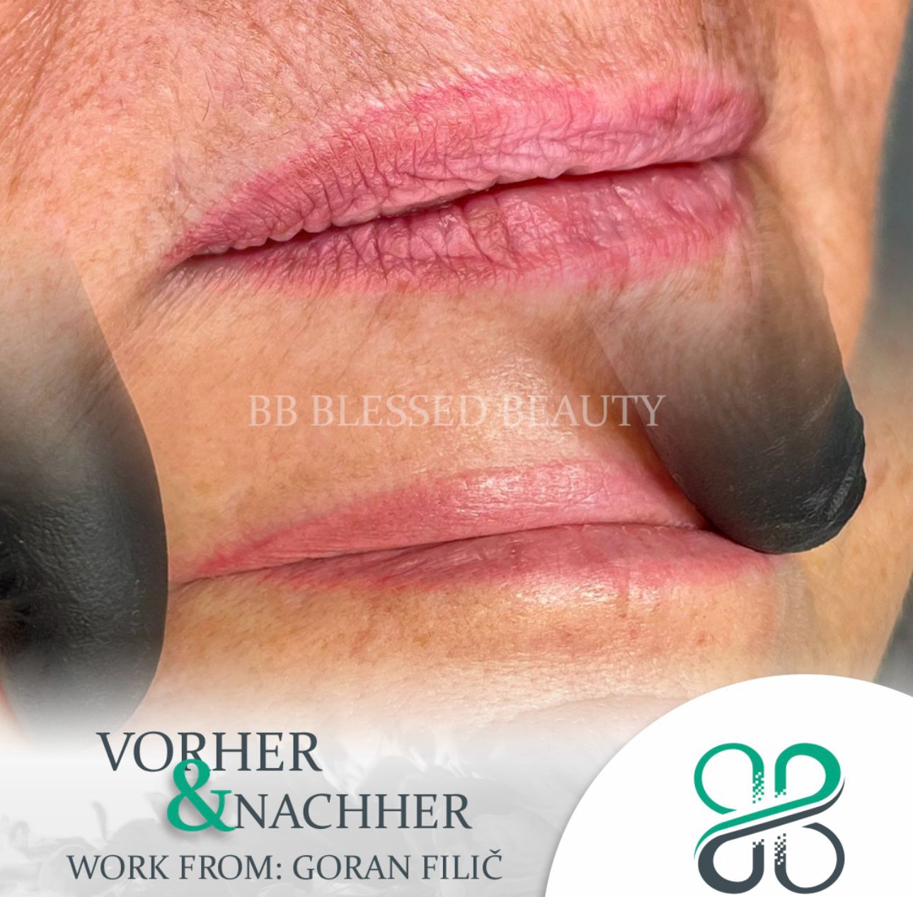 Remover für Lippen